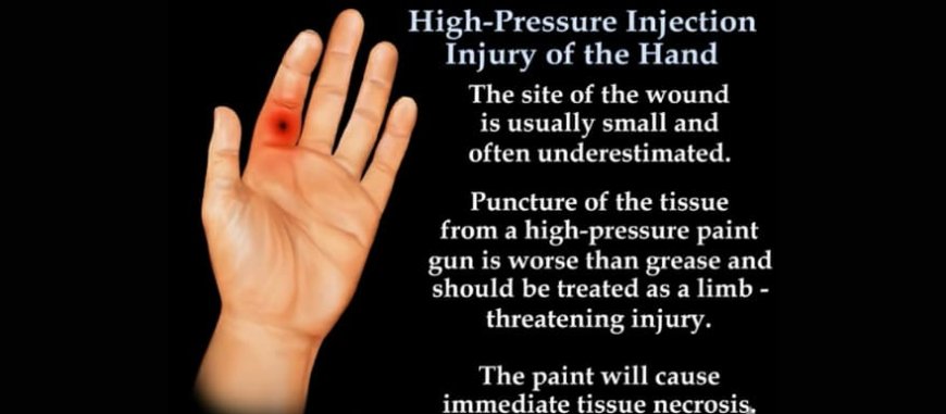 Understanding and Preventing a Hydraulic Injection Injury